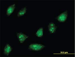H00079177-B01P - - Анти-ZNF577 Глувчето Polyclonal Антитела - Секој (50µG)